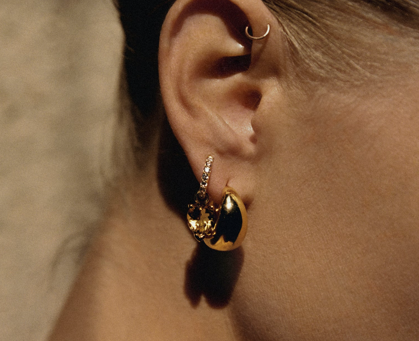 ARETES